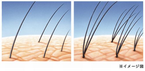 アートネイチャー増毛法のイメージ