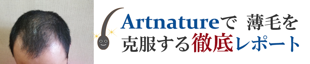 アートネイチャーの増毛の方法を徹底解説 【種類と選び方】