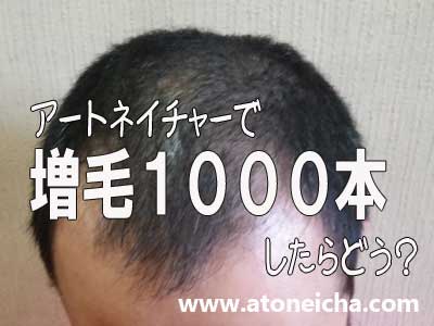 アートネイチャーの増毛1000本したらどう？